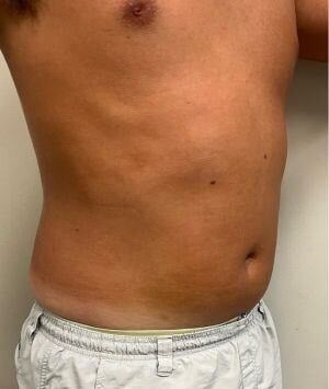 PHYSIQ 360: Burn Fat & Build Muscle with No Downtime